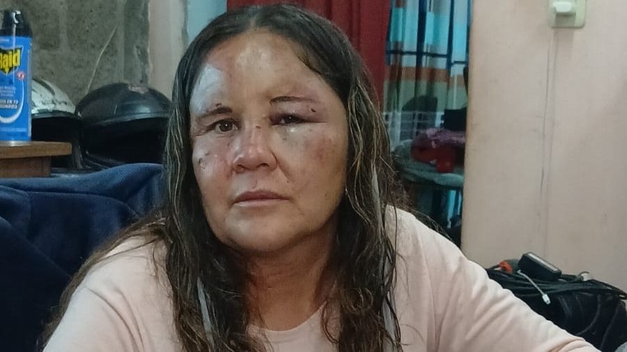 Ramona del Valle Anes 