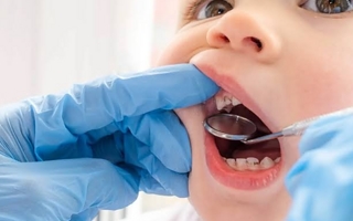 Alertan que 7 de cada 10 niños comienzan la primaria con caries