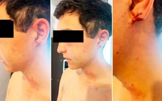 Un peón rural denunció torturas y amenazas de muerte por sus jefes