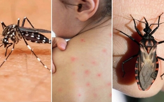 Aumentan los casos de enfermedad de Chagas fuera de América Latina