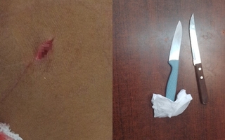 Violenta pelea por el robo de un celular dejó un herido de arma blanca