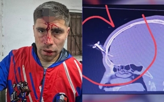 Una batalla campal terminó con un apuñalado en la frente con una llave