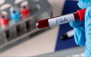 Este lunes realizaran controles gratuitos de próstata en la Plaza Seca