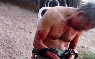 El hombre que fue agredido por su sobrino por una infidelidad tiene cráneo y mandíbula rota