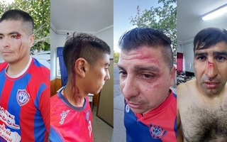 Violencia en el fútbol local: hinchas de Del Bono atacaron a jugadores de Villa Hipódromo