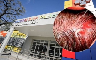 Una nena de Corrientes tenía gusanos en la cabeza que le perforaron el cráneo