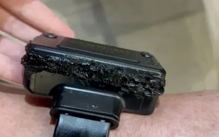 Bolsonaro intentó quemar su tobillera electrónico por paranoia