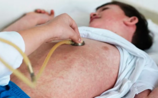Emitieron una alerta sanitaria por brote de sarampión 