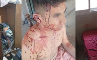 Simularon ser de la PFA, entraron a una casa y golpearon a su dueño para robarle