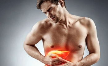 Cuánto alcohol aumenta el riesgo de hígado graso: diferencias entre hombres y mujeres