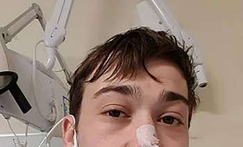 La historia del hombre que vomita 60 veces al día por una extraña enfermedad