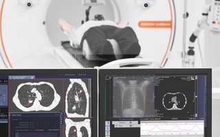 Cáncer de pulmón: el Marcial Quiroga lanzó estudios gratuitos de detección