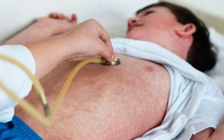 Confirman caso de sarampión en Entre Ríos y se reactiva la alerta sanitaria nacional