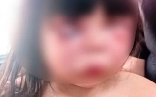 Vecinos detuvieron a un hombre que desfiguró a golpes a su hijastra de 7 años