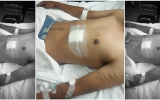 Apuñalaron a un cuidacoches y lo dejaron hospitalizado