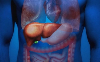 Qué es una falla multiorgánica, el cuadro que sufre el chef Christian Petersen