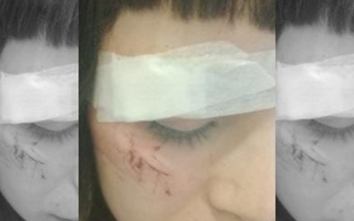 Una joven termina herida tras piedrazos de hinchas de Rivadavia en futsal