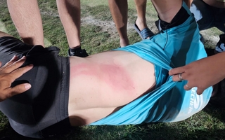 El duro relato del árbitro agredido en un partido de Liga Universitaria