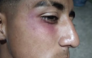 Un futbolista de Sarmiento fue herido por pirotecnia en pleno partido