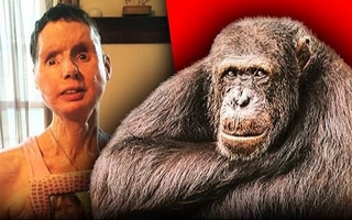 La historia de Carla Nash, la mujer a la que le arrancó la cara un chimpancé