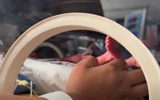 Nacieron trigemelas en Argentina, el milagro que ocurre cada millón de embarazos